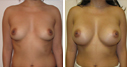 Before & After Photos